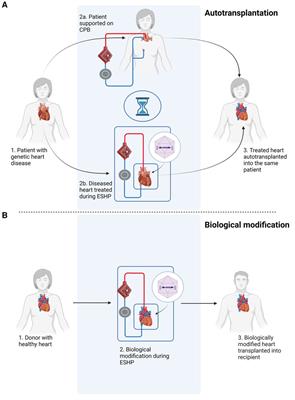 Gene therapy during ex situ heart perfusion: a new frontier in cardiac regenerative medicine?